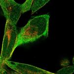 RPRD1B Antibody in Immunocytochemistry (ICC/IF)