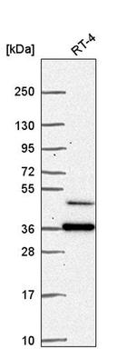 RPRD1B Antibody in Western Blot (WB)