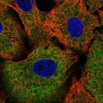 TRIM16 Antibody in Immunocytochemistry (ICC/IF)