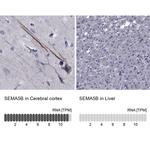 SEMA5B Antibody in Immunohistochemistry (IHC)
