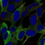 SEMA5B Antibody in Immunocytochemistry (ICC/IF)