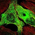 SYCE1L Antibody in Immunocytochemistry (ICC/IF)