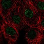 SIVA1 Antibody in Immunocytochemistry (ICC/IF)