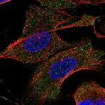 TARSL2 Antibody in Immunocytochemistry (ICC/IF)