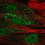 TTL Antibody in Immunocytochemistry (ICC/IF)