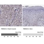 RBM24 Antibody in Immunohistochemistry (IHC)