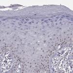 RBM24 Antibody in Immunohistochemistry (IHC)