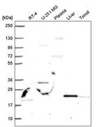 JAZF1 Antibody in Western Blot (WB)