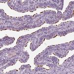 HYDIN Antibody in Immunohistochemistry (IHC)