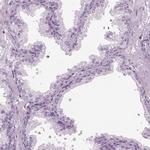 HYDIN Antibody in Immunohistochemistry (IHC)