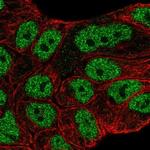 ABCA6 Antibody in Immunocytochemistry (ICC/IF)