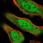 CNOT2 Antibody in Immunocytochemistry (ICC/IF)