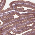 CNOT2 Antibody in Immunohistochemistry (IHC)