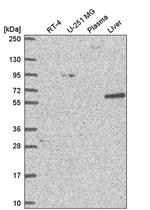 NCAPH2 Antibody in Western Blot (WB)