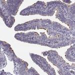 STMND1 Antibody in Immunohistochemistry (IHC)