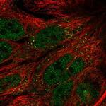 TTI1 Antibody in Immunocytochemistry (ICC/IF)