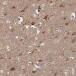 beta-1 Adaptin Antibody in Immunohistochemistry (IHC)