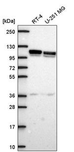 beta-1 Adaptin Antibody in Western Blot (WB)