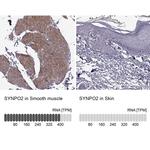 SYNPO2 Antibody