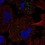 FGFR5 Antibody in Immunocytochemistry (ICC/IF)