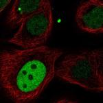 KIF23 Antibody in Immunocytochemistry (ICC/IF)