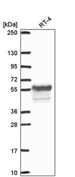 WEE1 Antibody in Western Blot (WB)