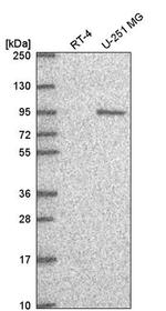 GTF3C4 Antibody in Western Blot (WB)