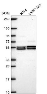 DAGLB Antibody in Western Blot (WB)