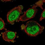 MAD3 Antibody in Immunocytochemistry (ICC/IF)