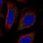 PPAPDC3 Antibody in Immunocytochemistry (ICC/IF)