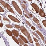 PPAPDC3 Antibody in Immunohistochemistry (IHC)