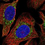 PDPR Antibody in Immunocytochemistry (ICC/IF)