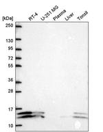 ATP5J2 Antibody in Western Blot (WB)