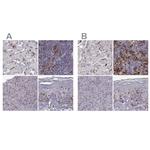 Cyclin F Antibody in Immunohistochemistry (IHC)