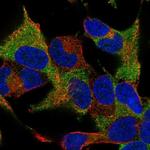 WIPF1 Antibody in Immunocytochemistry (ICC/IF)