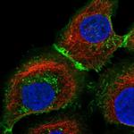 MCT1 Antibody in Immunocytochemistry (ICC/IF)