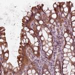 SLC25A46 Antibody in Immunohistochemistry (IHC)