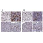 Cyclin F Antibody in Immunohistochemistry (IHC)