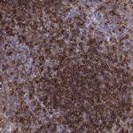 Cyclin F Antibody in Immunohistochemistry (IHC)