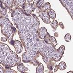 CHST14 Antibody in Immunohistochemistry (IHC)