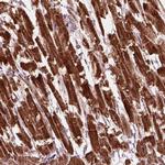 SLC25A5 Antibody in Immunohistochemistry (IHC)