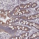 MRPS27 Antibody in Immunohistochemistry (IHC)