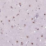 MAGEB3 Antibody in Immunohistochemistry (IHC)