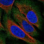 ZDHHC22 Antibody in Immunocytochemistry (ICC/IF)