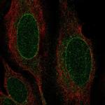 Nurim Antibody in Immunocytochemistry (ICC/IF)