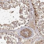 PICK1 Antibody in Immunohistochemistry (IHC)