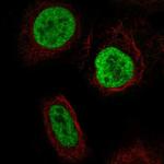 YTHDC2 Antibody in Immunocytochemistry (ICC/IF)