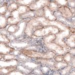 SLC16A2 Antibody in Immunohistochemistry (IHC)