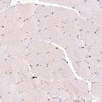 SLC16A2 Antibody in Immunohistochemistry (IHC)