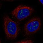 UBE2W Antibody in Immunocytochemistry (ICC/IF)